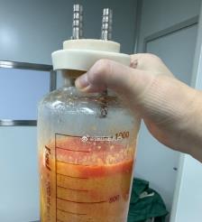 寿光水动力吸脂手术要做多久？